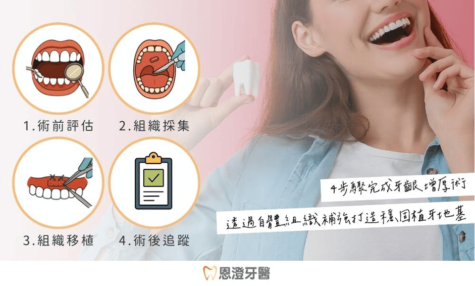什麼是牙齦增厚術？手術流程一次看懂